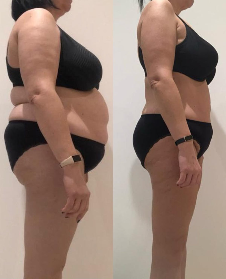 Antes y después Slimzy