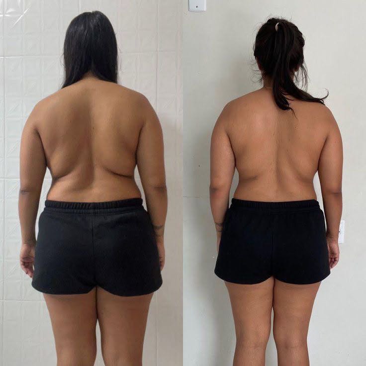 Antes y después Slimzy